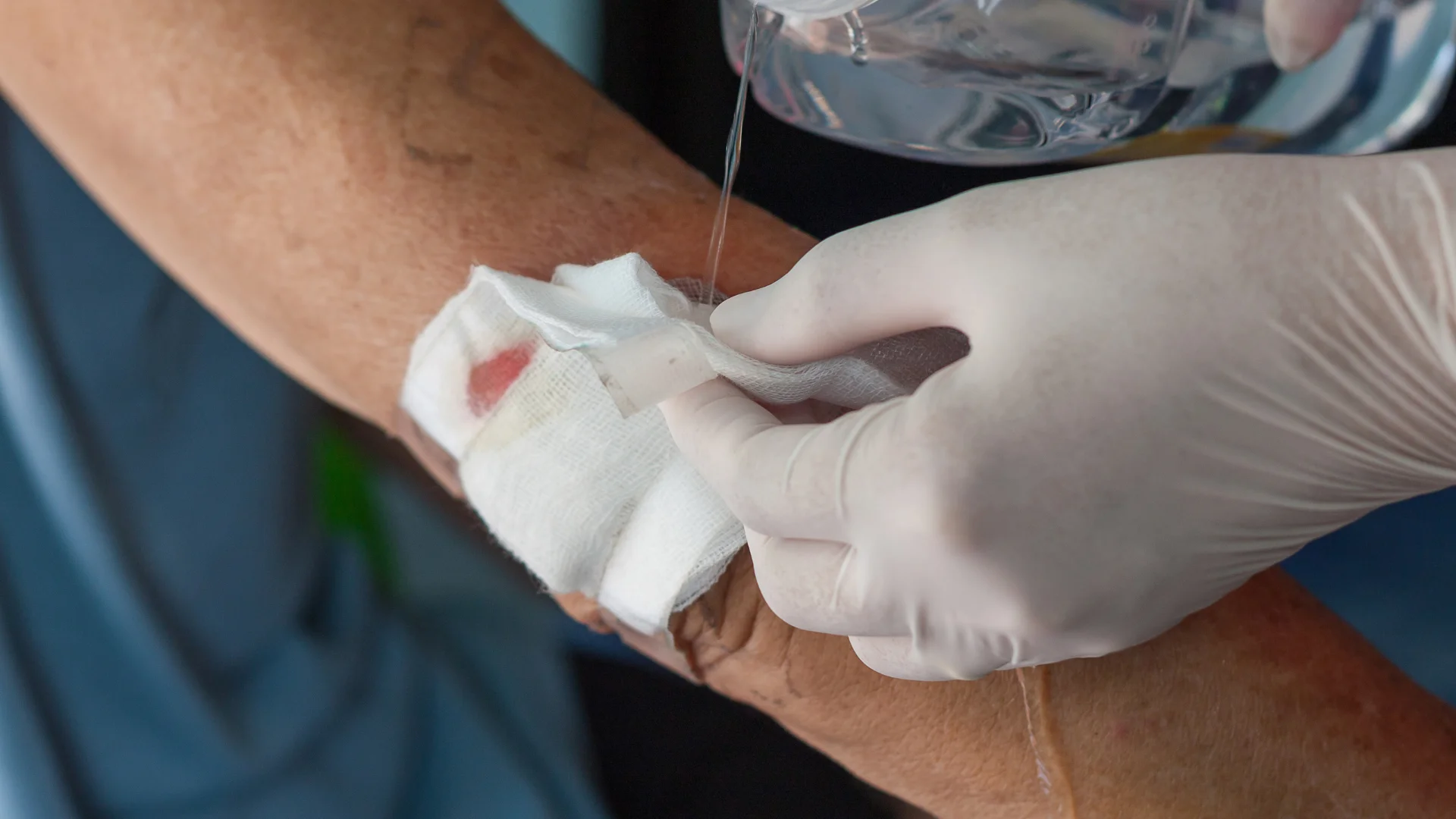 Tipos de heridas